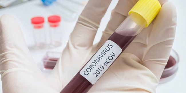 15 dakikada sonuç veren koronavirüs testi geliştirildi