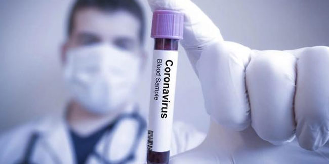 Araştırmaya göre koronavirüs havada 3 saate yaşayabiliyor
