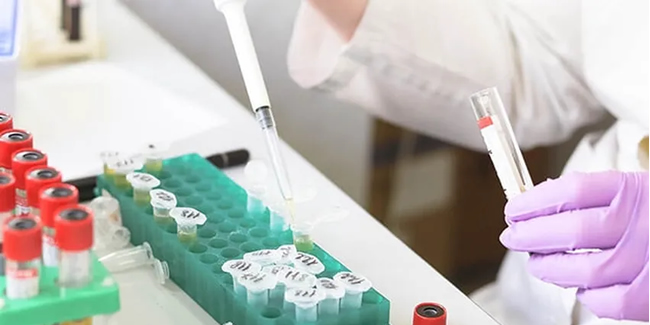 Bilim insanları 20 dakikada sonuç veren antikor testi geliştirdi