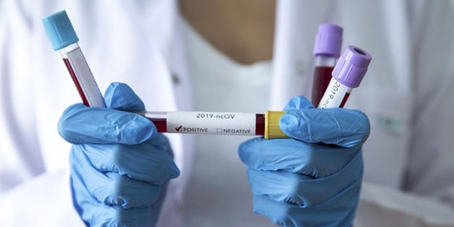 İsrail koronavirüsün tedavisini buldu iddiası