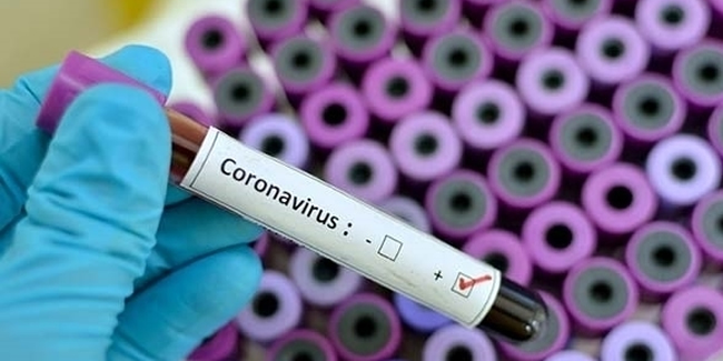 İran'da corona virüs kaynaklı can kaybı 7 bin 508'e yükseldi