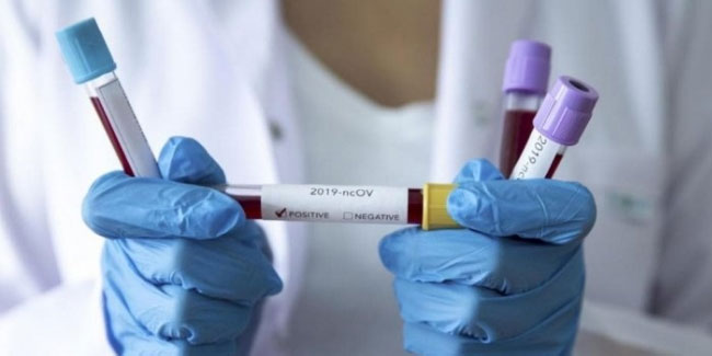 İran'da koronavirüsten 221 ölüm daha