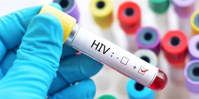 AIDS'e karşı yeni umut: Maymunlarda HIV virüsünü öldüren aşı geliştirildi