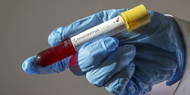 Özel sağlık sigortası koronavirüs tedavisini karşılıyor mu?