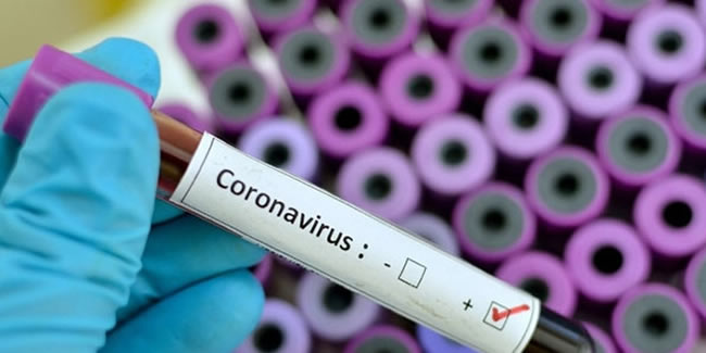 Koronavirüs ile ilgili o soru cevabını buldu