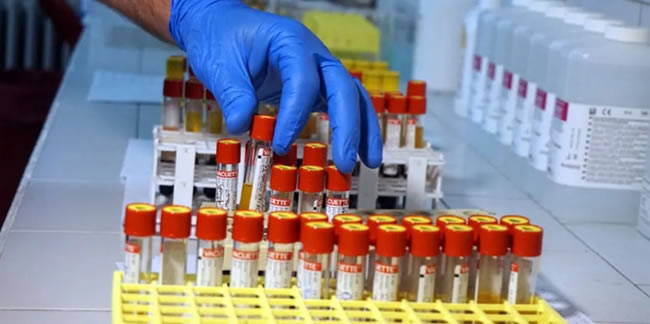 Koronavirüste yeni umut: Ölümleri yüzde 85 azaltıyor