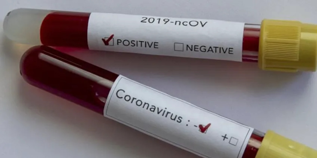 Koronavirüs bir ülkede daha görüldü
