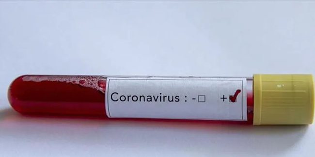 Brezilya'da yeni tip corona virüsten ilk ölüm