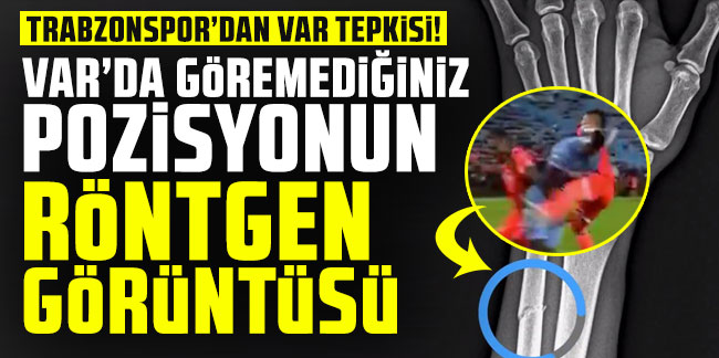Trabzonspor'dan VAR tepkisi! VAR’da göremediğiniz pozisyonun röntgen görüntüsü