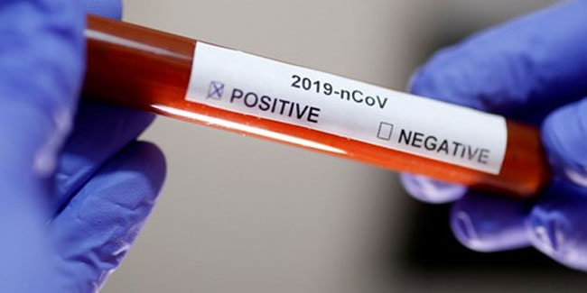 Korona virüs ilacı Almanya'da bulundu: Tam başarı sağlandı 
