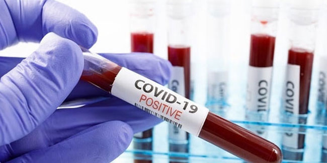 Uzmanlar açıkladı: Koronavirüsün öldürücülüğü azaldı mı?