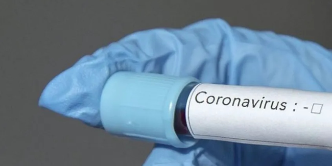 Koronavirüs tedbiri: Hasta kabulü durduruldu