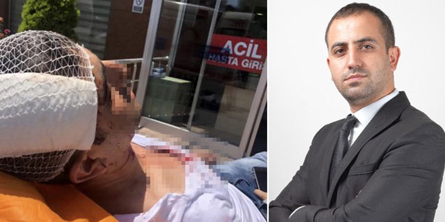 Akit Haber Müdürü Murat Alan'a saldırı