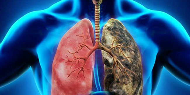 Akciğer kanseri erken teşhisle tedavi ediliyor