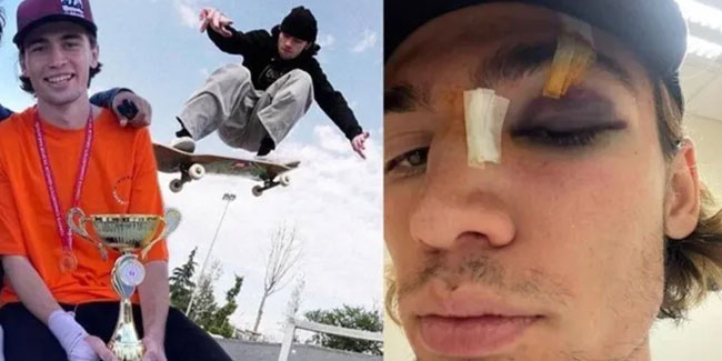 Milli sporcu Alpaslan Ayhan kavgayı ayırmak isterken hastanelik oldu
