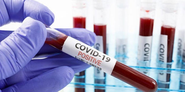Koronavirüsün kimler için ölümcül olduğunu gösteren test