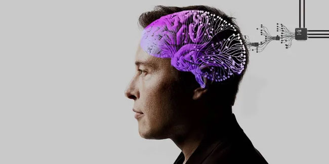 Elon Musk'ın Neuralink çipi 'Telepati', ilk kez bir insanın beynine yerleştirildi