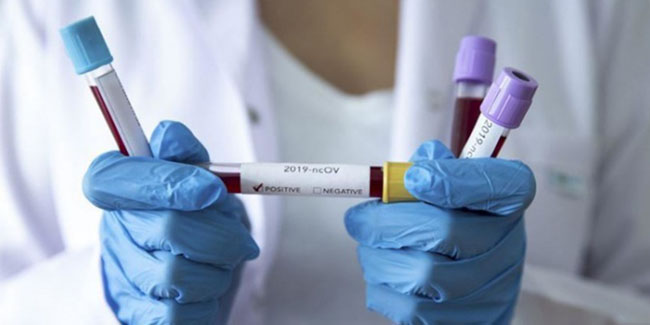 Avustralya'da klinikte korona virüsü alarmı