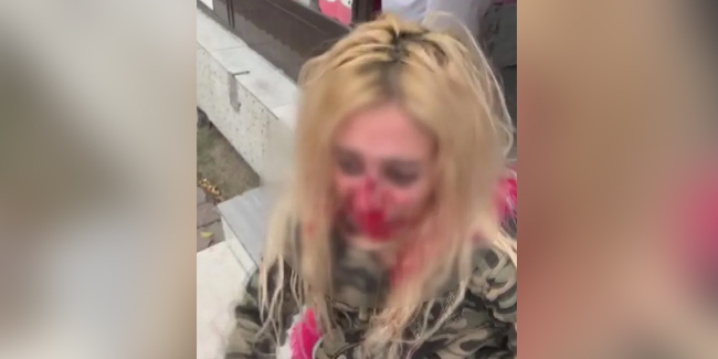 Gaziosmanpaşa'da kadına kafa atarak kanlar içinde bıraktı