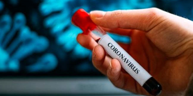 Avustralya'da koronavirüsün tedavisi bulundu!