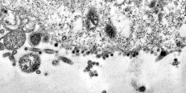 Bilim adamları koronavirüsün hücreye saldırı anını görüntüledi