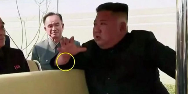 Kim Jong-un’un fotoğrafındaki ''tedavi'' detayı