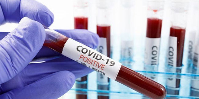 Koronavirüsle ilgili en yanlış bilgi bakın hangisi çıktı