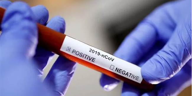 ABD'de koronavirüsten son 24 saatte 452 ölüm