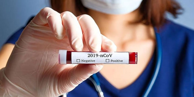 Türkiye'de kaç kişiye koronavirüs testi yapıldı?