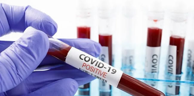 Koronavirüsün bir mutasyonu daha tespit edildi