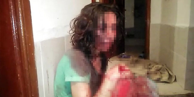 Antalya'da kocasından öldüresiye şiddet gören kadını polis kurtardı