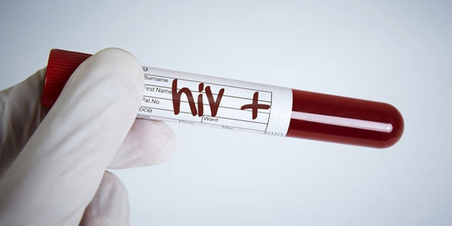 Türkiye'de yeni tehlikenin adı, HIV! 5 yılda %400 arttı