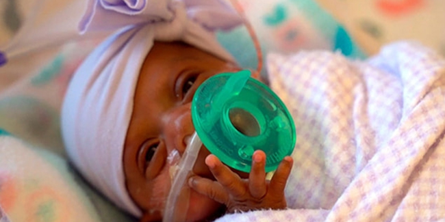 Dünyanın en küçük bebeği Saybie yaşam savaşını kazandı