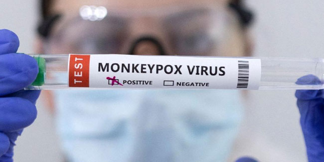 Maymun çiçeği virüsü İngiltere’de kontrol altına alınamıyor