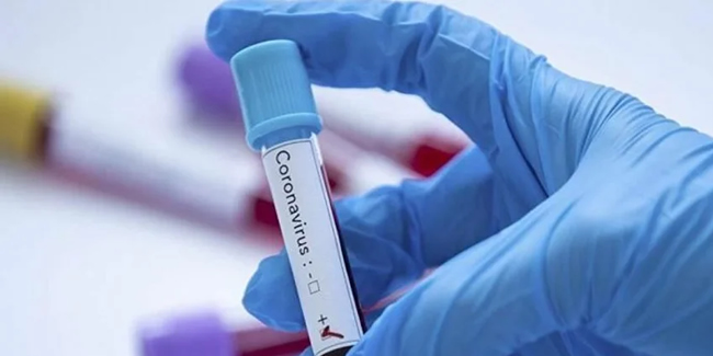 PCR testi pozitif çıkan hastanın tedavisi için devletten ödeme