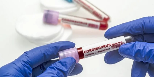 Asya'da koronavirüsün ardından ikinci bir virüs paniği!
