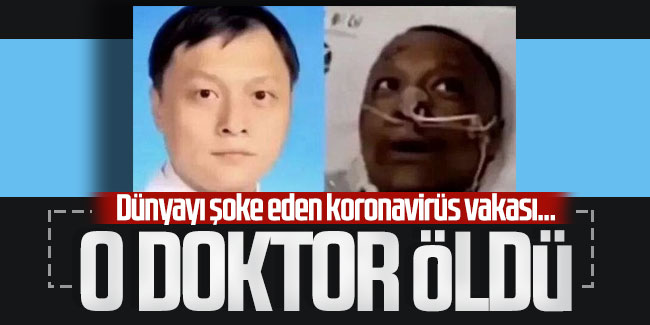 Ten rengi değişen Çinli doktor koronavirüsten öldü