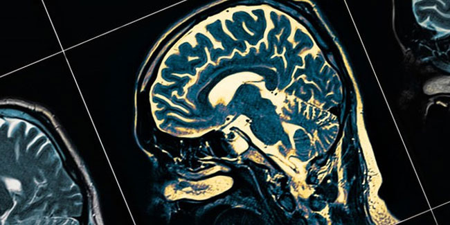 Bilim insanlarından Alzheimer için çığır açacak çalışma
