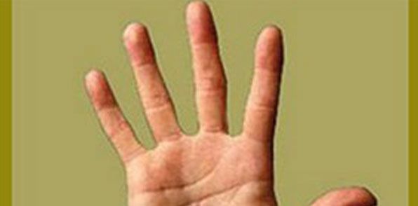İşaret parmağınız uzunsa riskiniz az