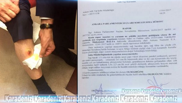 Trabzon Milletvekili ısırıldı mı? İşte o rapor…