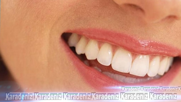Diş beyazlatma ile sararan dişlere son